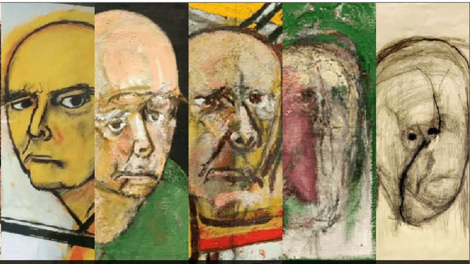Morbo-di-Alzheimer-il-declino-cognitivo-negli-autoritratti-di-W.-Utermolhen.jpeg Morbo-di-Alzheimer-il-declino-cognitivo-negli-autoritratti-di-W.-Utermolhen.jpeg